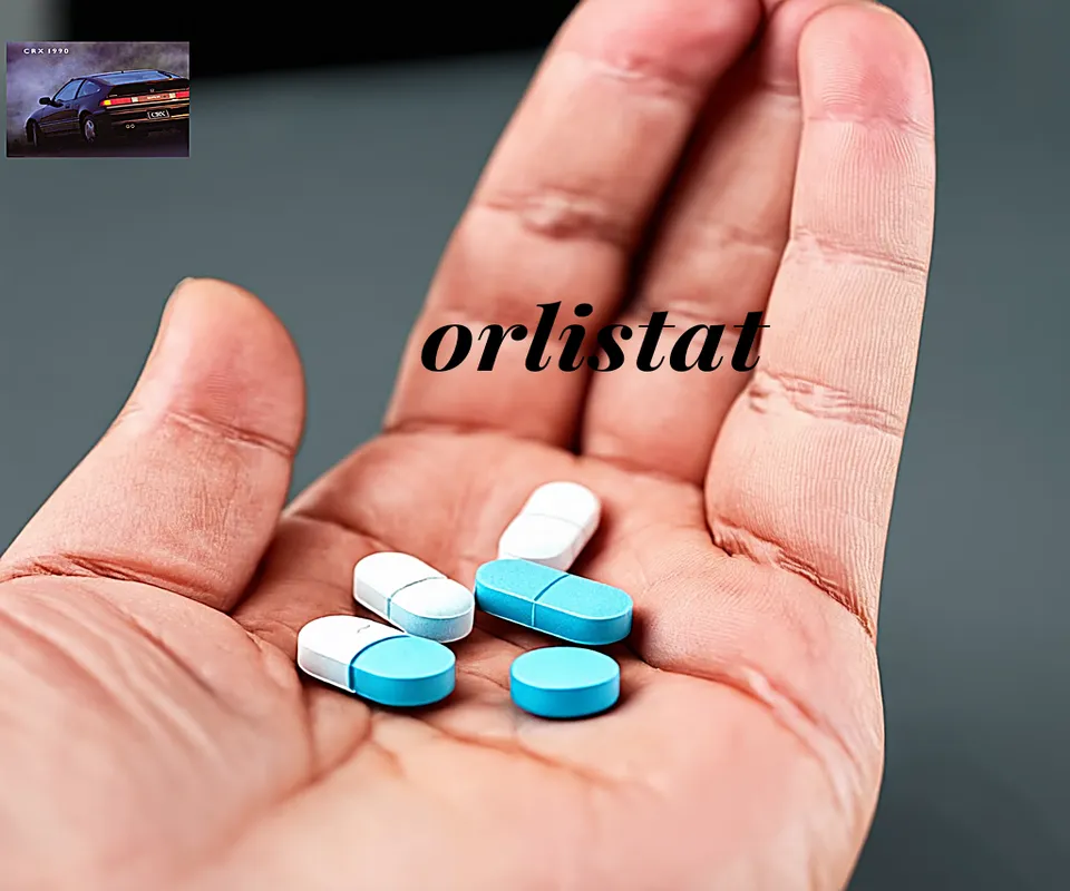 Se puede comprar orlistat sin receta